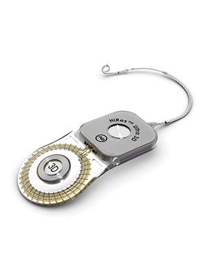 hires ultra 3d with hifocus mid scala electrode