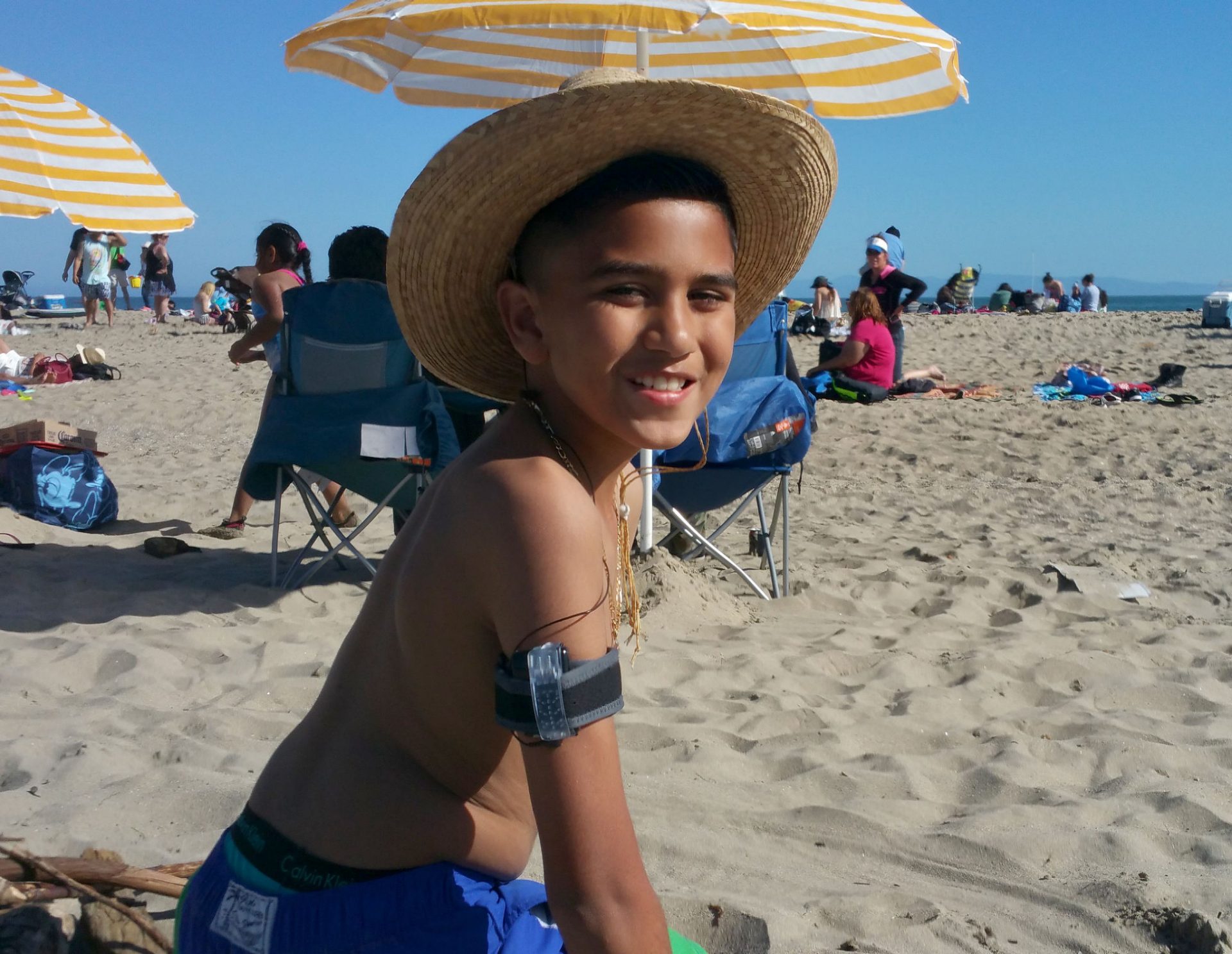 ivan on the beach with a straw hat cochlear implant sound processor in a case and attached to the arm with an armband