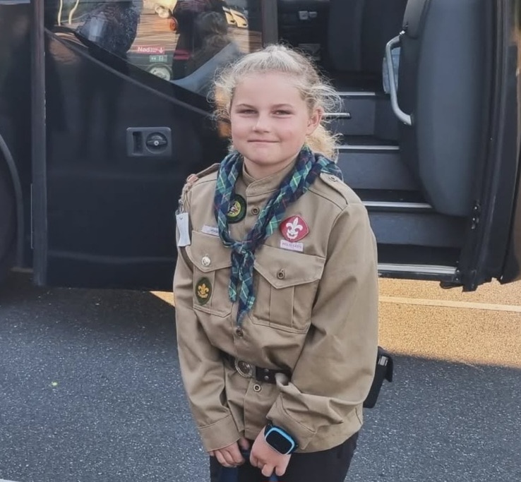 A girl smiles for the camera wearing cochlear implants for children