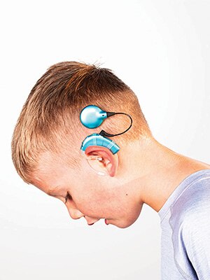 side view of a child with a cochlear implant