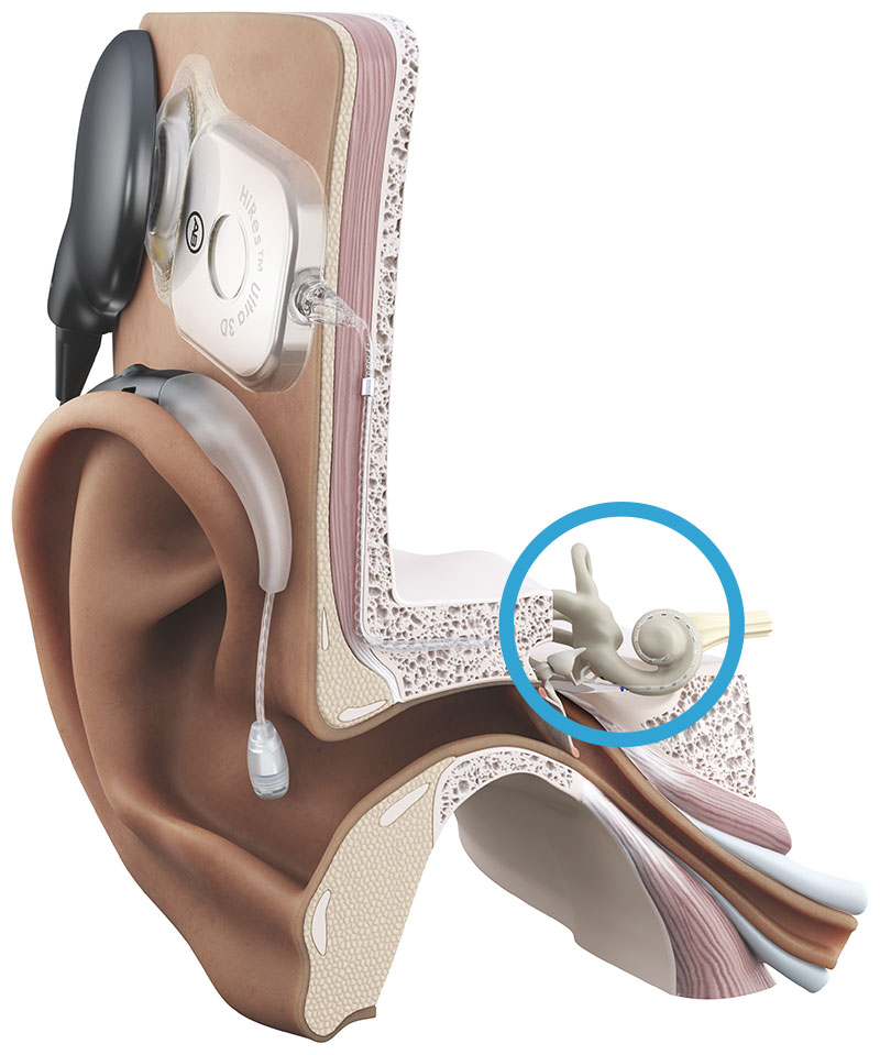 graf viser et høreområde