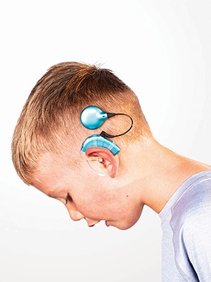 side view of a child with a cochlear implant
