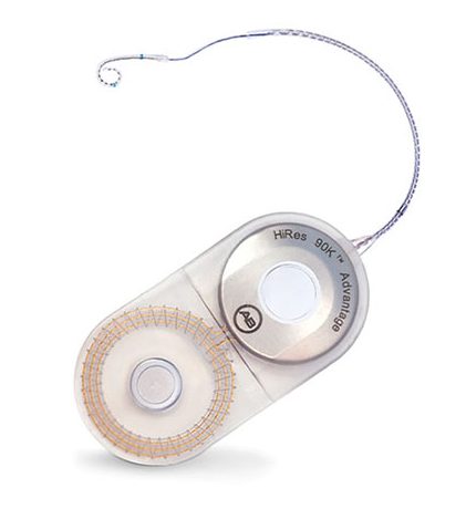 hires 90k advantage implant