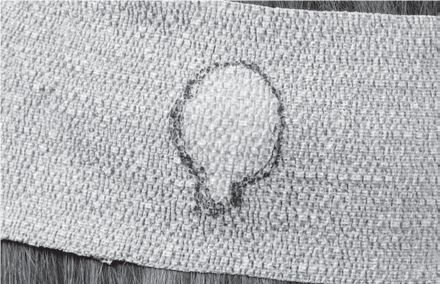 Marked bandage showing outline of headpiece