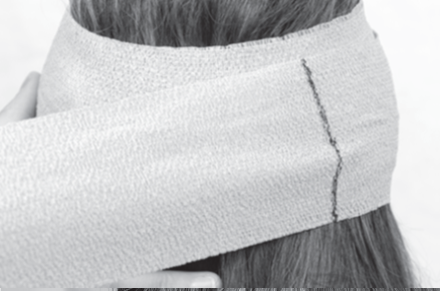 Apply compression bandaging