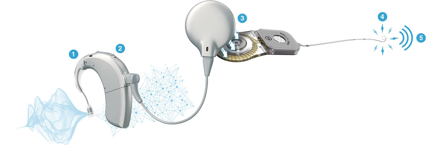 diagram how a ci works
