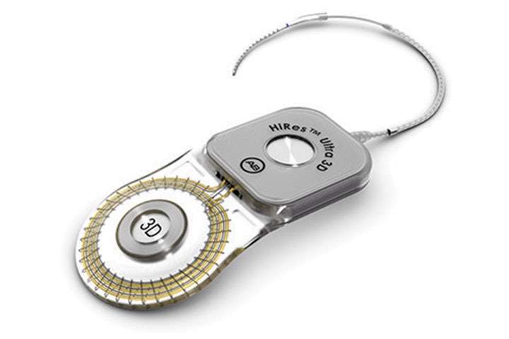 HiRes Ultra 3D Implant