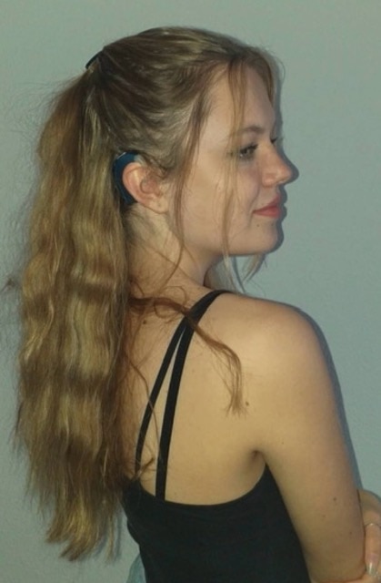 Mia shows off her bilateral cochlear implant from Advanced Bionics