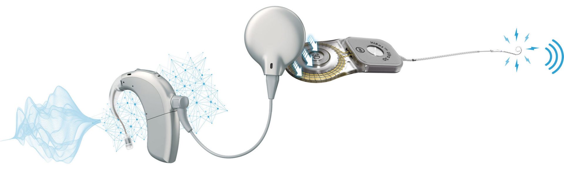 A diagram showing how the Naída CI Marvel cochlear implant sound processor works
