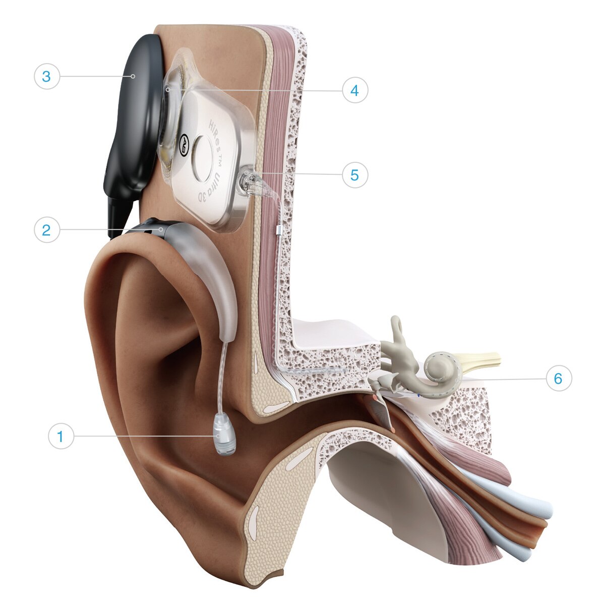 028-N084-03 RevC What is a CI and How it Works Flyer.indd