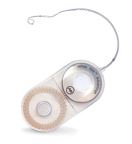 hires 90k advantage implant