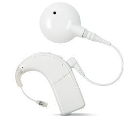 Naída CI Q90 spraakprocessor met T-Mic 2 microfoon en zendspoel in de kleur Alpine White